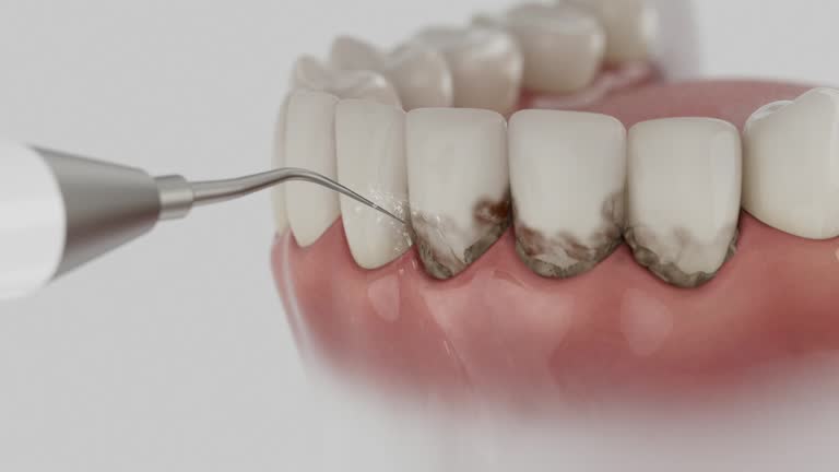 Trusted Dental Crowns And Bridges service in Pecan Plantation, TX - Dentist Open Now